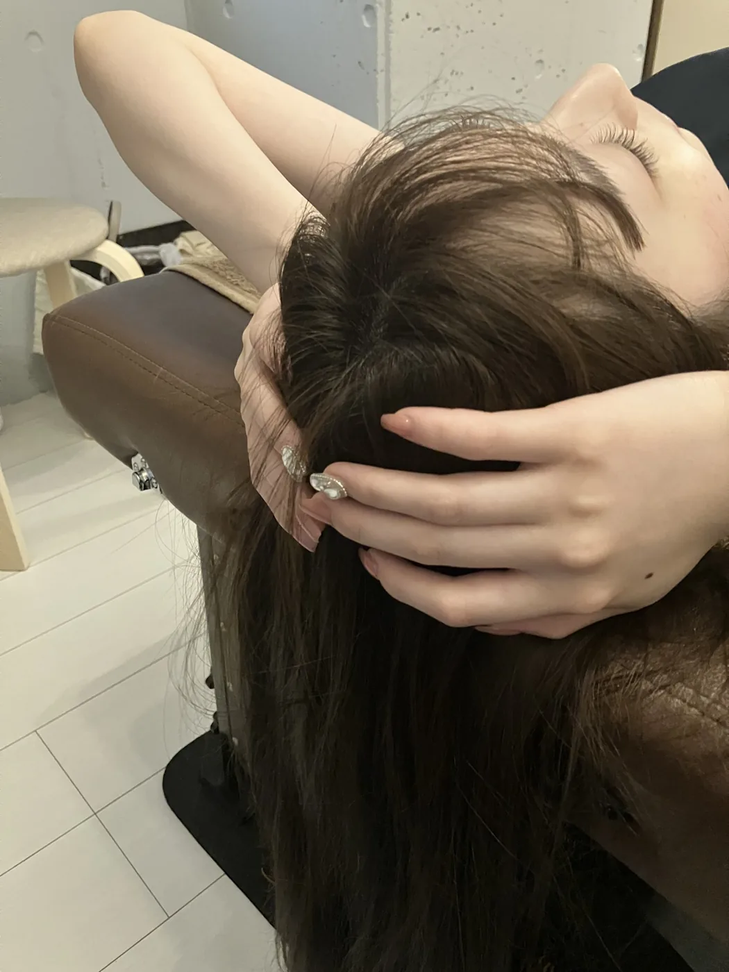 小顔矯正の施術後イメージ